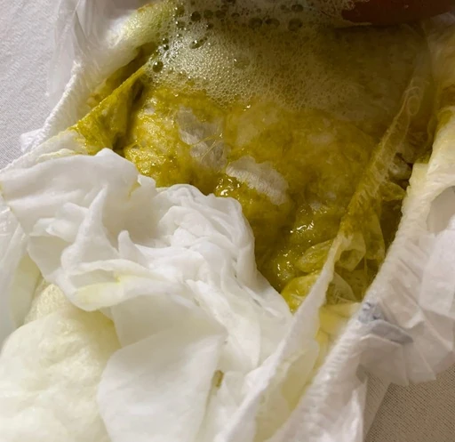 Green-frothy-poo Green frothy poo