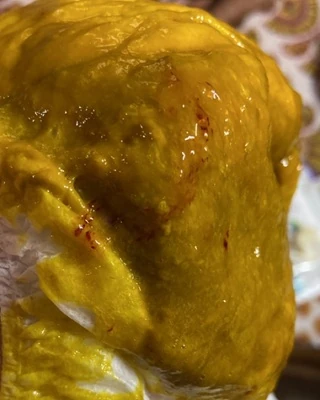 blood-and-mucous blood and mucous